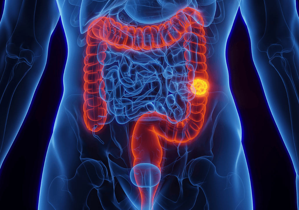 Colorectal cancer screening